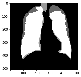 透過OpenCV實作CXR肺分割